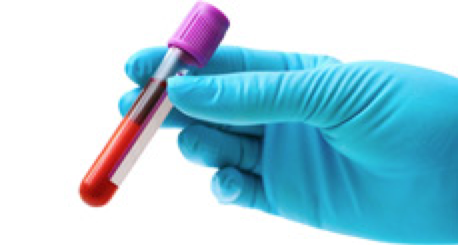 Биохимический анализ крови асло повышен